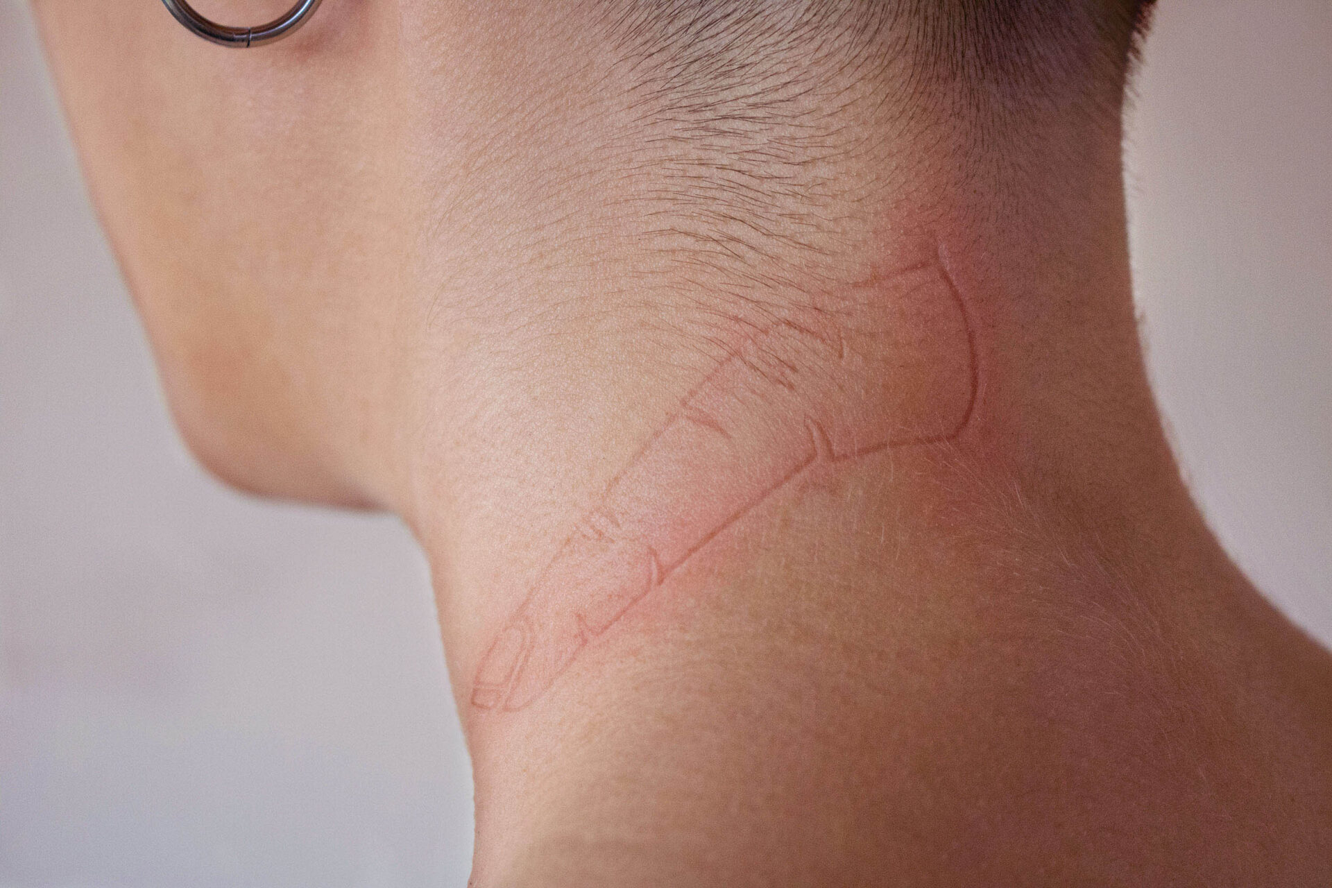 Woman Scratch The Itch With Hand Neck Red Spots On The Neck Allergies  Psoriasis Insect Bite Malaria Sunburn Sun Burn Stock Video - Download Video  Clip Now - iStock